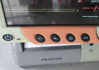 85dB病院の徴候モニター、使用されたフィリップス3000Aのリアルタイムのヘルス モニタリング システム